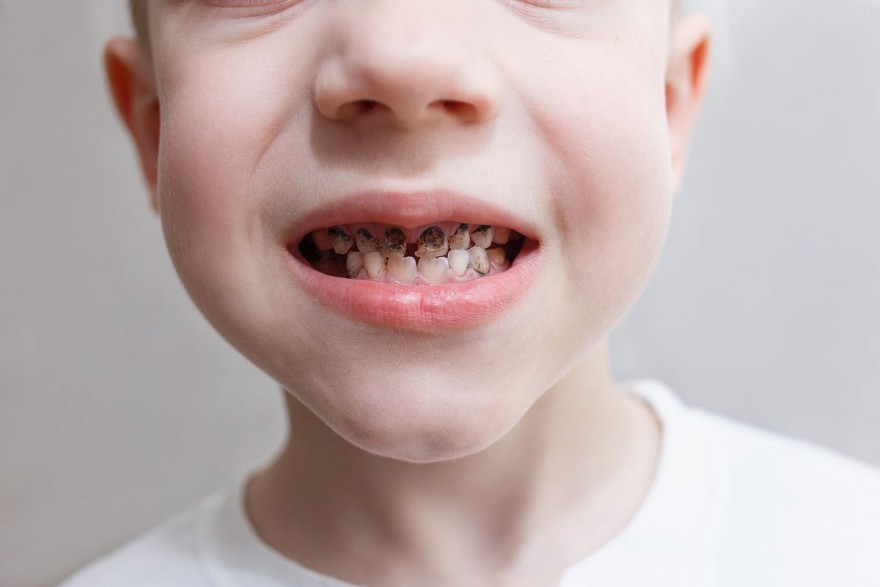 przedszkolak i problemy z zębami