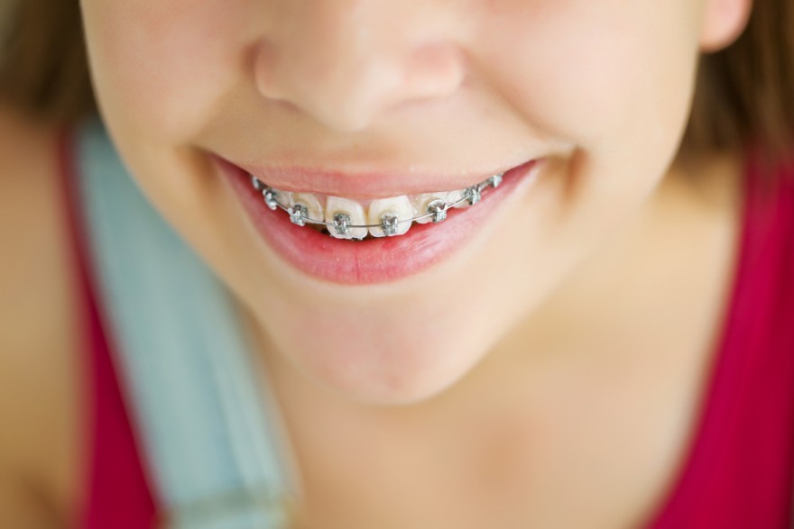 Ortodonta dziecięcy: Klucz do zdrowego uśmiechu od najmłodszych lat