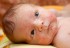 Wysypka u małych dzieci i niemowląt – najczęstsze przyczyny